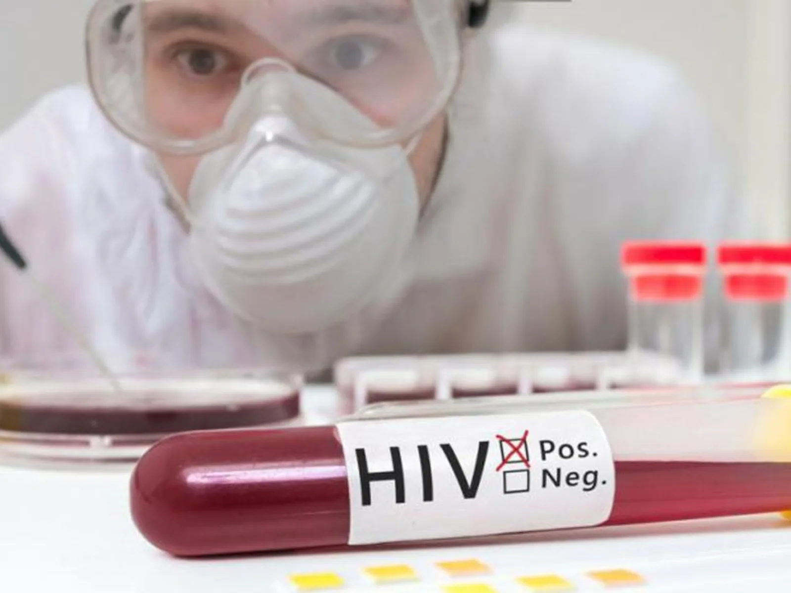 hiv