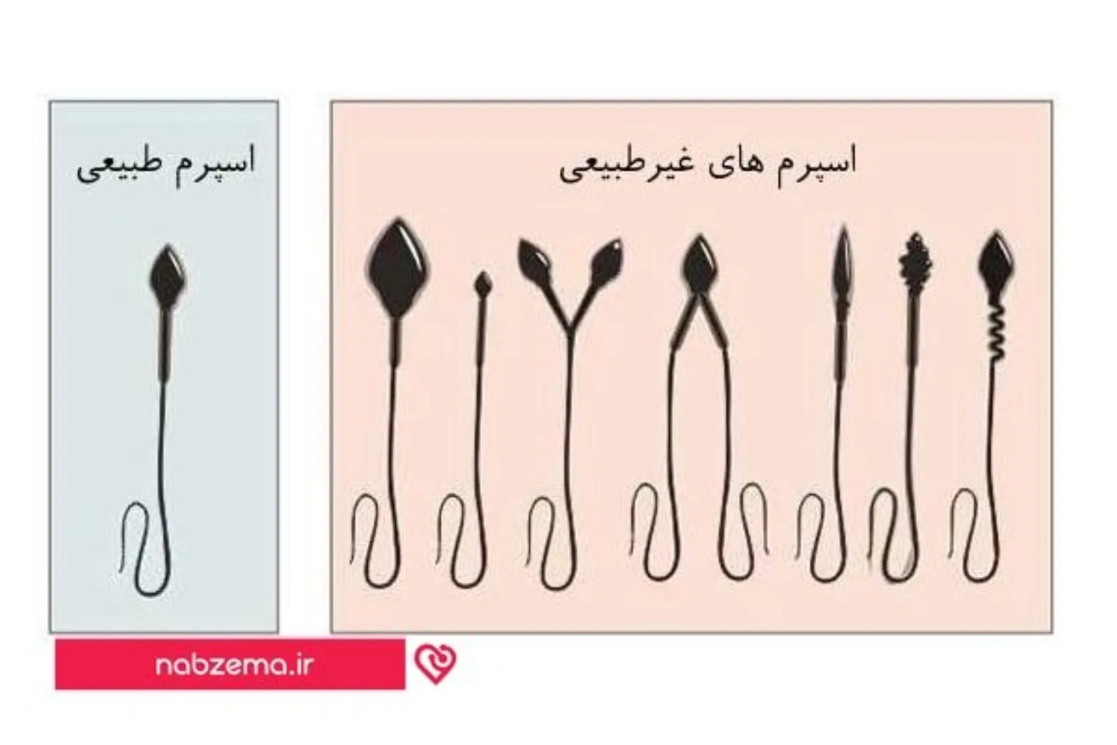 اسپرم طبیعی