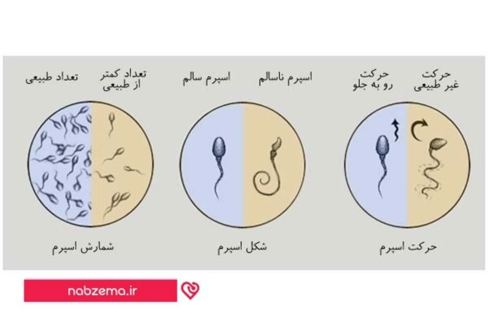 عکس اسپرم