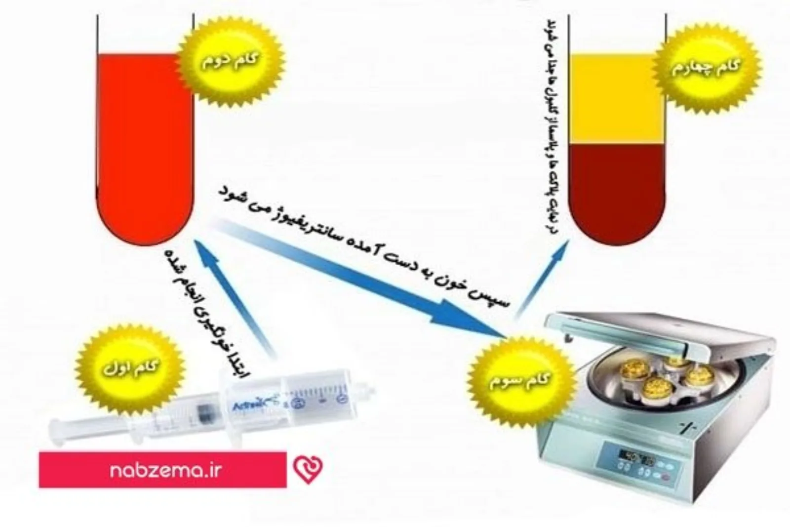 پلاسمای غنی از پلاکت