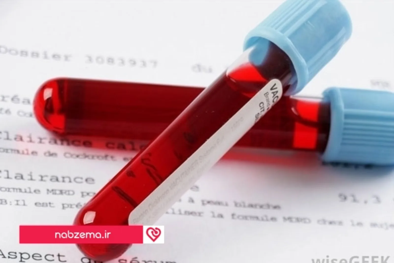 آزمایش خون در بارداری