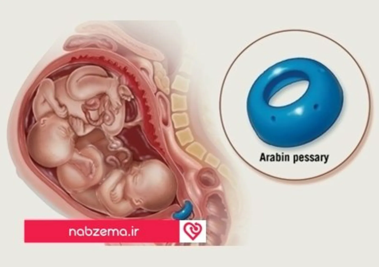 دوقلو