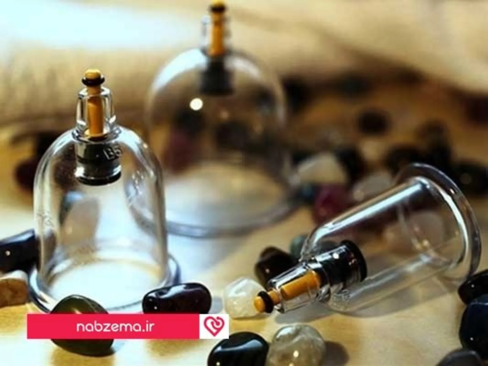 حجامت کردن