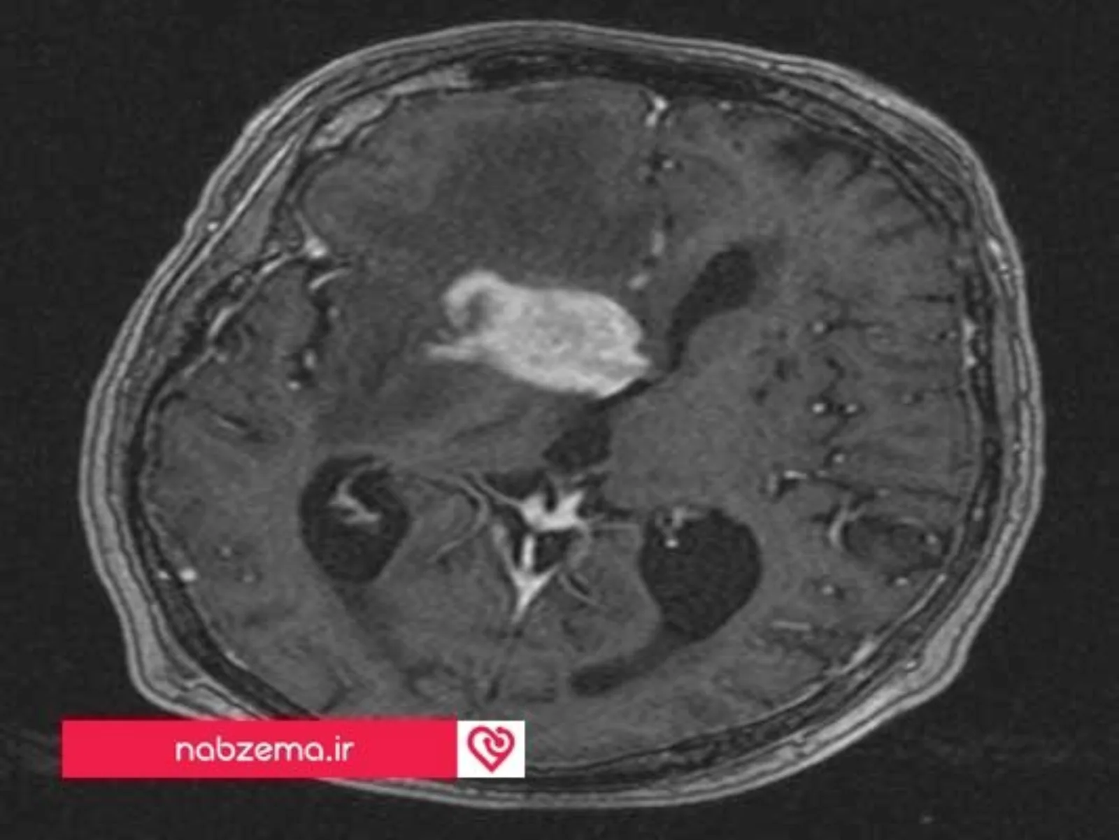کیفیت تصویری دستگاه MRI