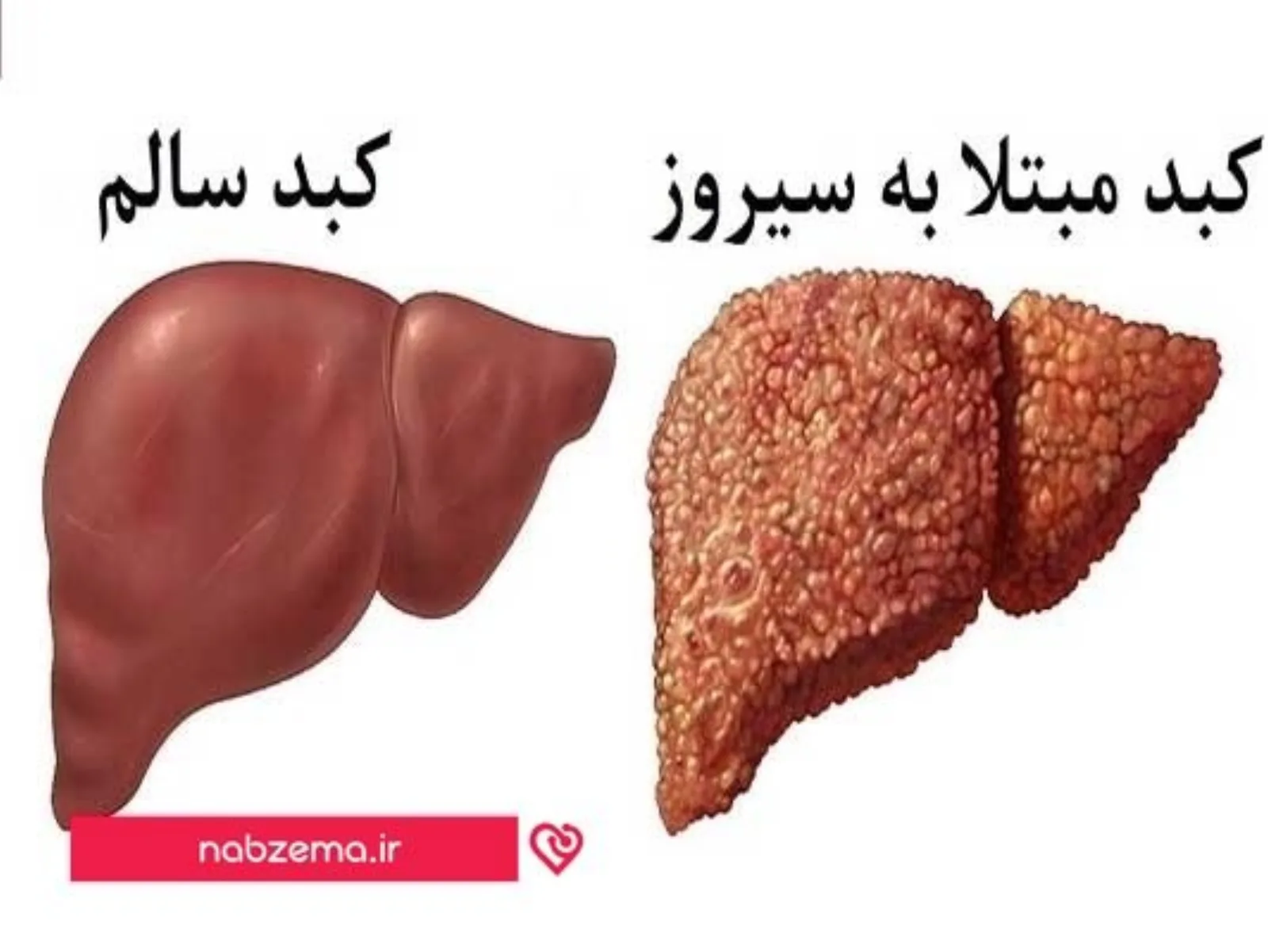 سیروز