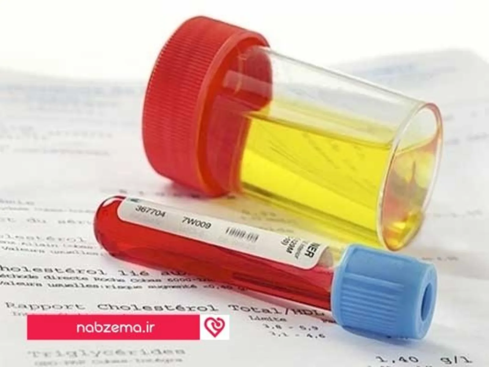 کراتینین در ادرار