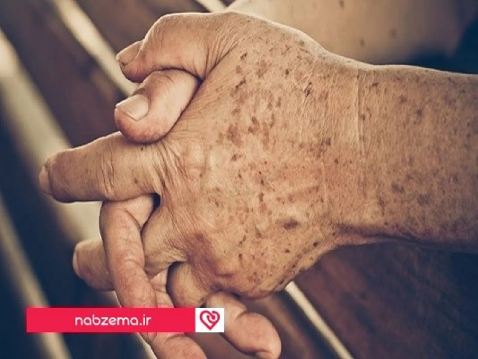 چین و چروک پوست