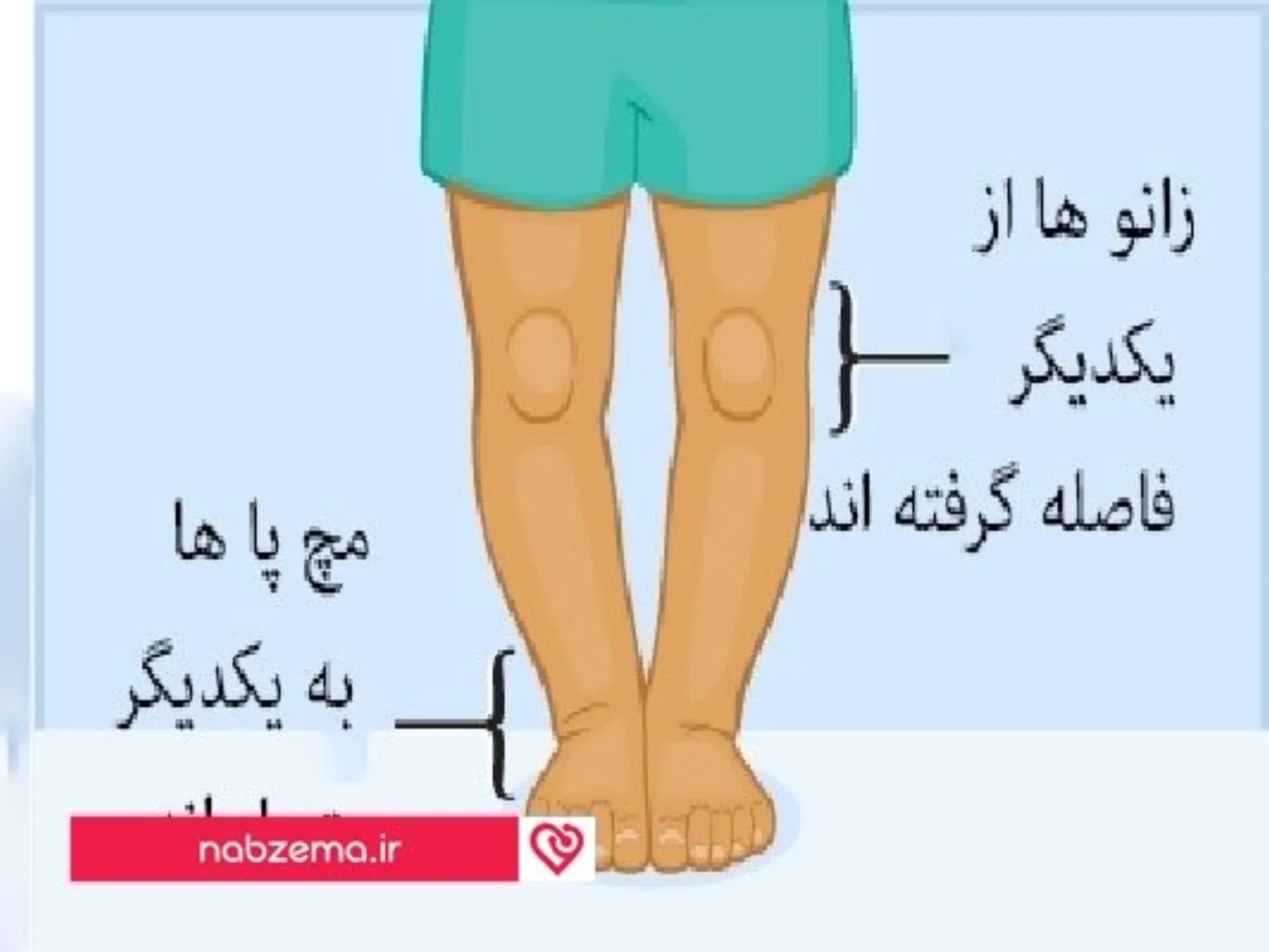 پای پرانتزی