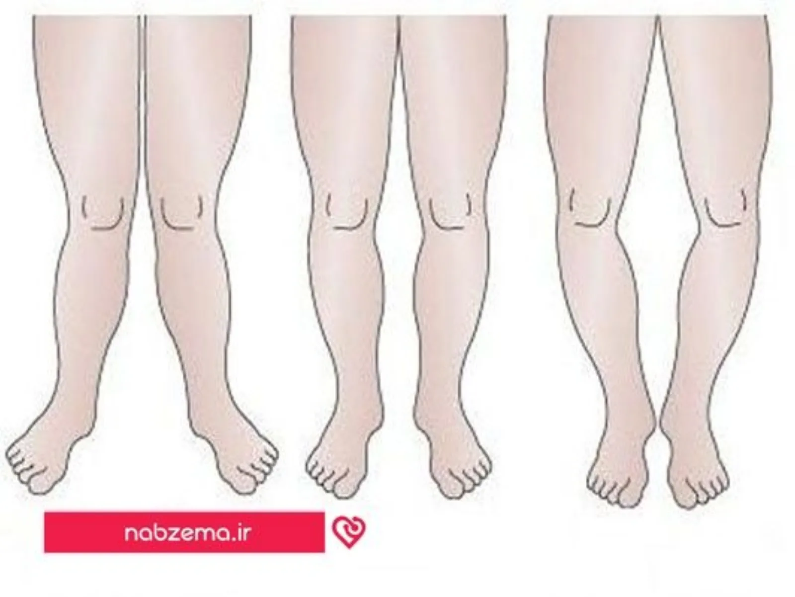 عکس پای پرانتزی