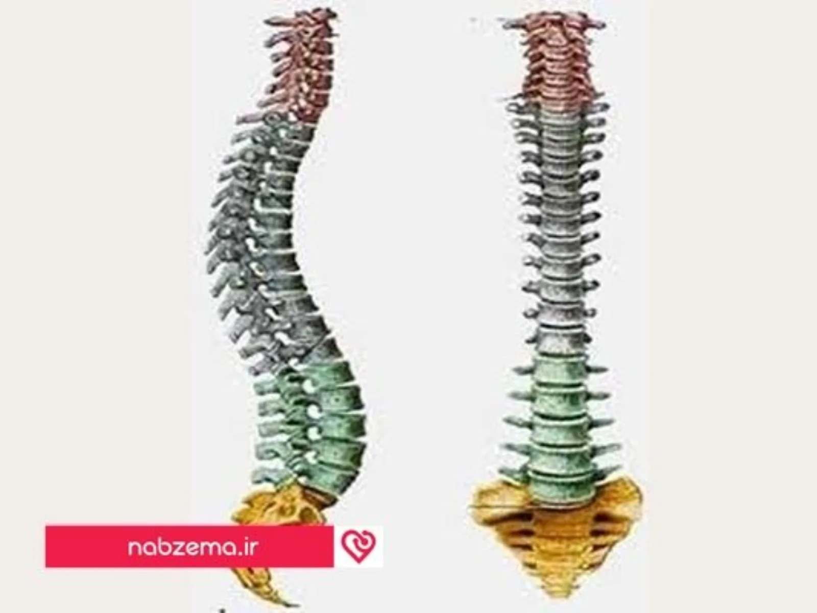 انحنای ستون فقرات