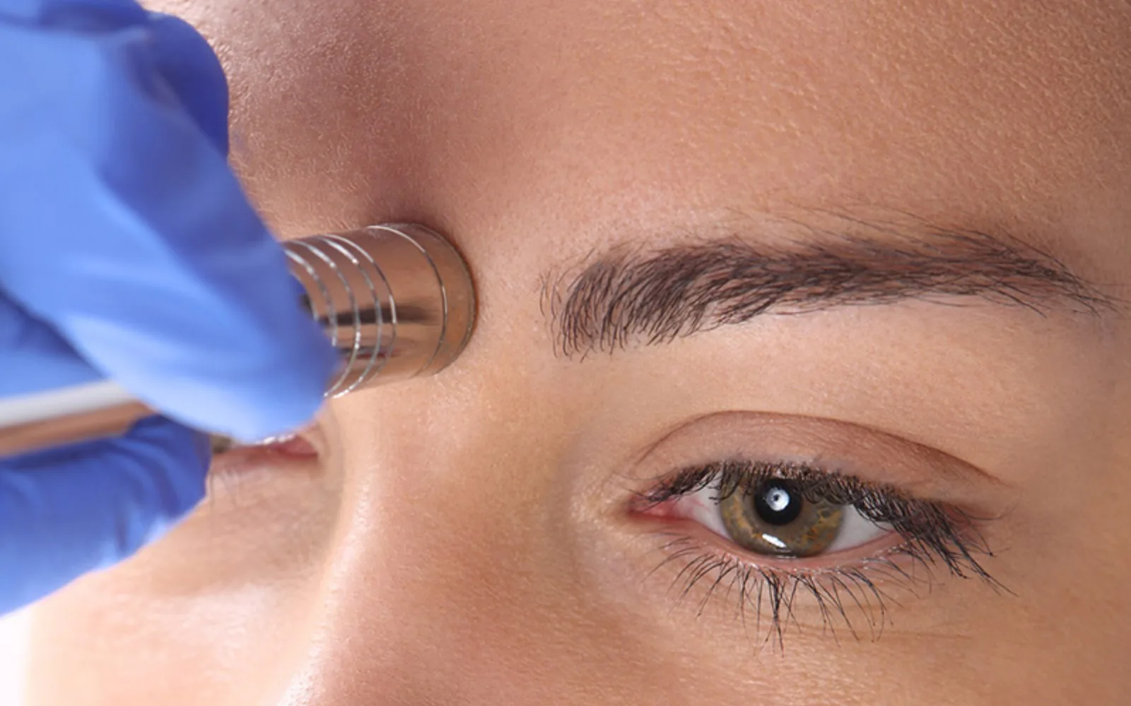 dermabrasion