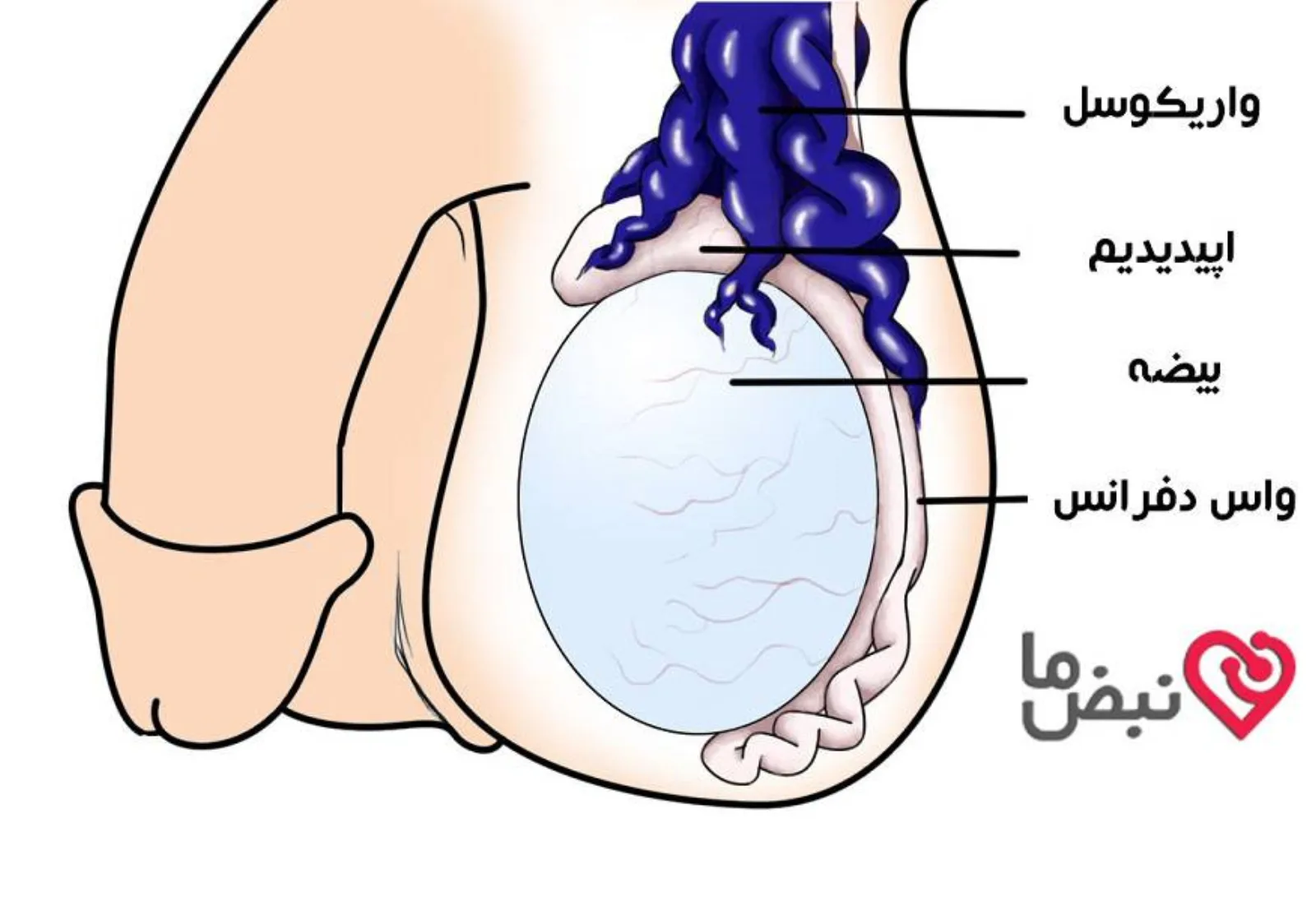 علت واریس بیضه