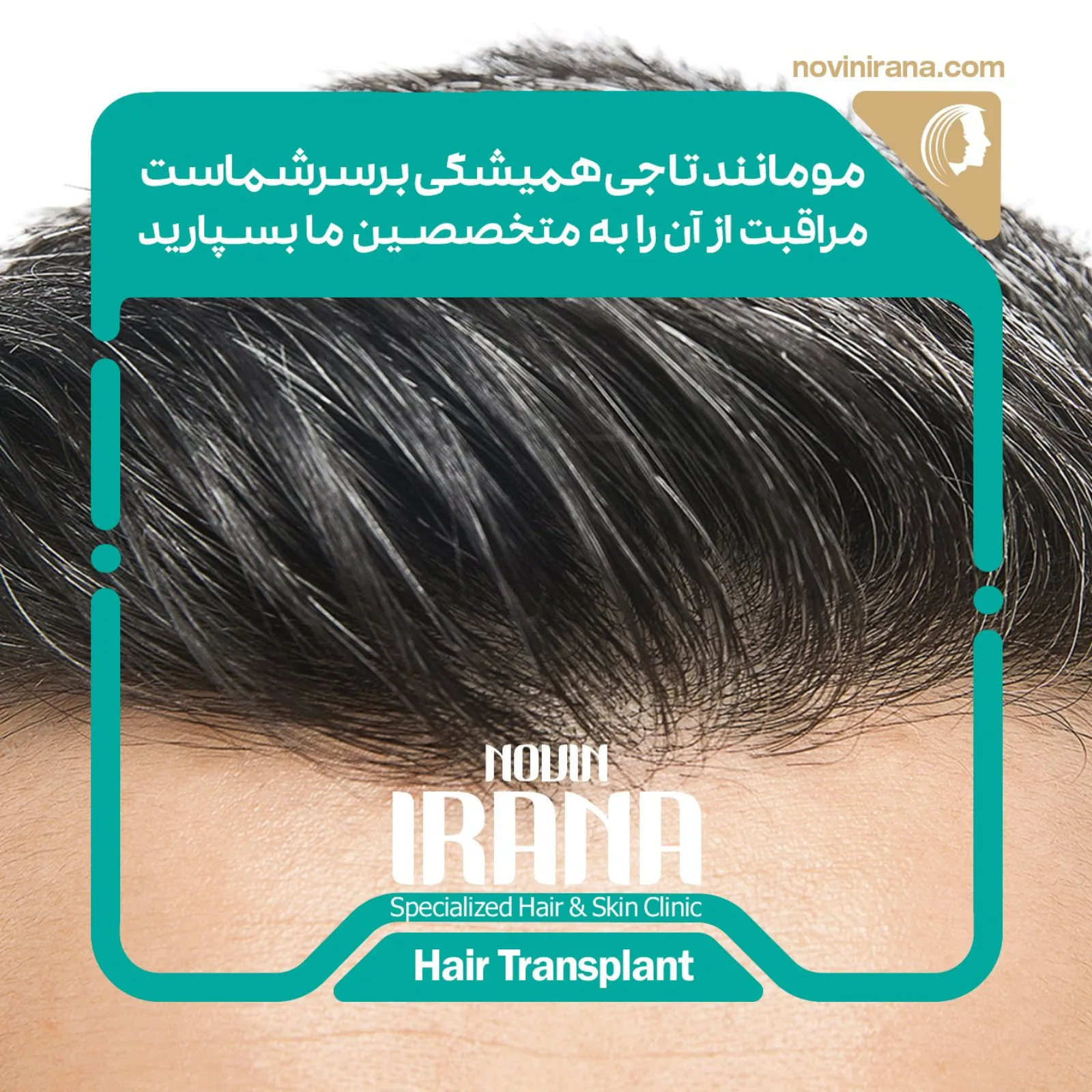زراعة الشعر - کاشت مو - شفط الدهون