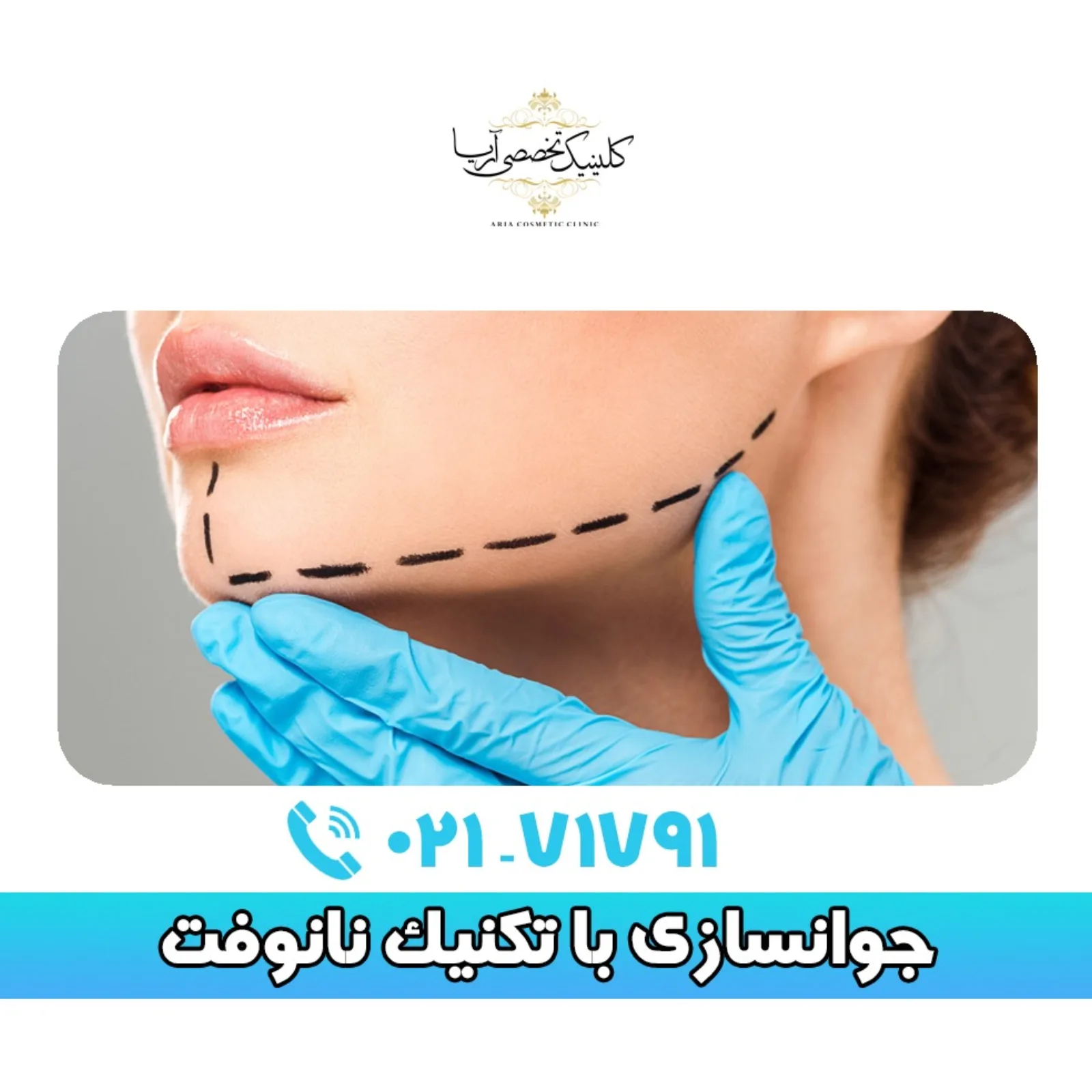 نانوفت چیست؟