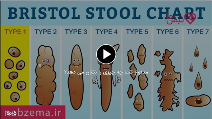 آزمایش مدفوع