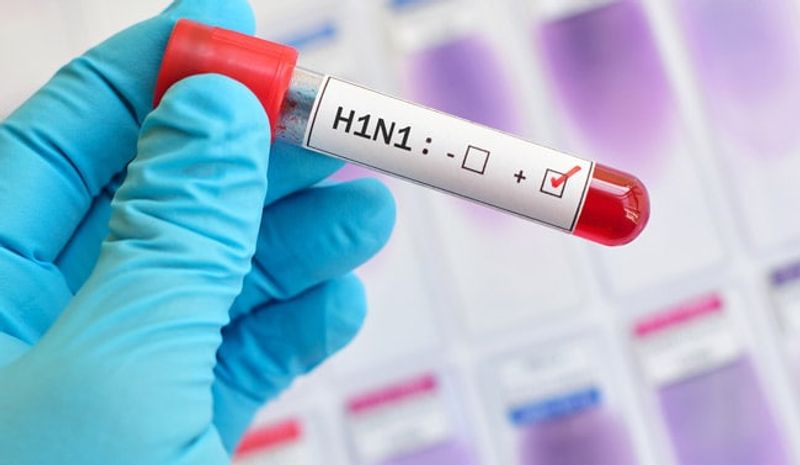 تشخیص انفولانزای h1n1