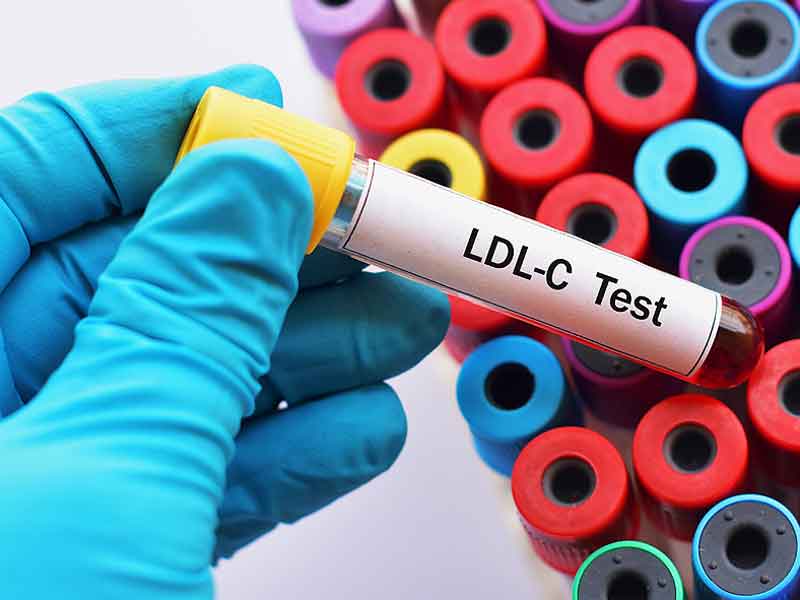 آنچه باید در مورد داروی ضد چربی خون بدانید