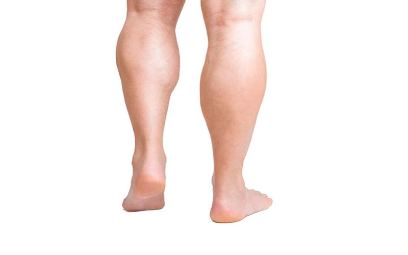 در مورد پروتز ساق پا چه می دانید؟