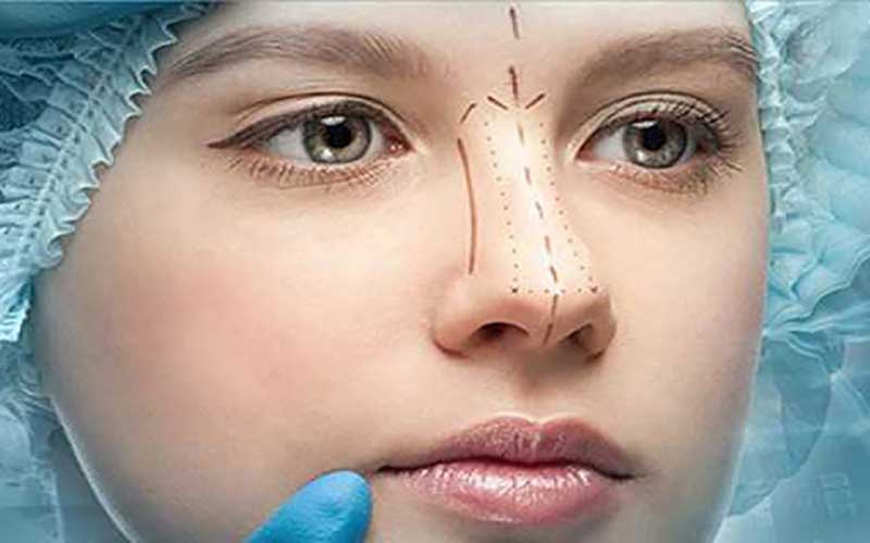 جراحی بینی به کمک قالب بینی