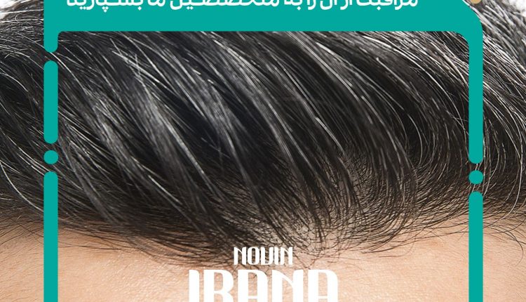 زراعة الشعر - کاشت مو - شفط الدهون